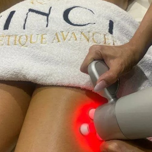 Vinci Estética Avanzada